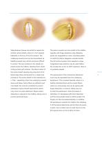 Inion S-2™ Surgical-5