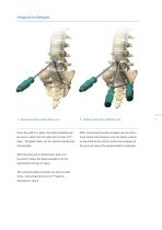 Inion S-2™ Surgical-9