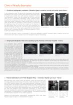 GlassBONE™ Bioglass Bone Substitute-5