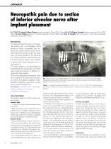 Neuropathic pain due to section of inferior alveolar nerve after implant placement - 1