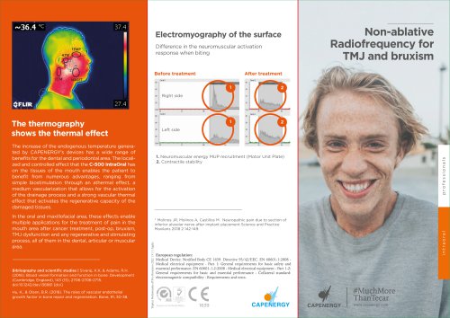 TMJ and bruxism