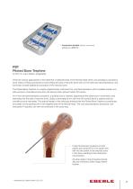 PBT Piloted Bone Trephine-3