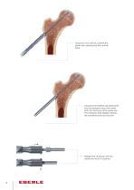 PBT Piloted Bone Trephine-4