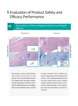 Singclean Peripheral Nerve Guide  Brochure-8