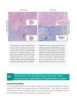 Singclean Peripheral Nerve Guide  Brochure-9