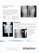 Complete Planning Solution for Knee Procedures-5