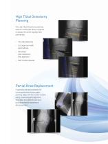 Digital Planning and Templating for Orthopaedics-13