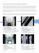 Digital Planning and Templating for Orthopaedics-3