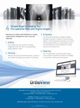 Digital Planning and Templating for Orthopaedics-4