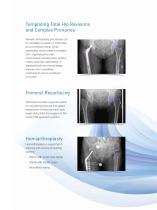 Digital Planning and Templating for Orthopaedics-7