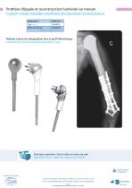 Custom-made implants-3