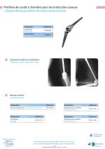 Custom-made implants-5
