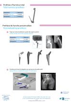 Custom-made implants-6