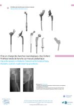 Custom-made implants-7