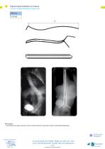 Spine-3