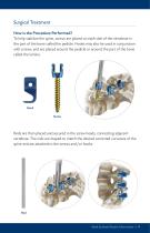 ADULT SCOLIOSIS - 11