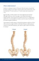 ADULT SCOLIOSIS - 6