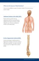 ADULT SCOLIOSIS - 7