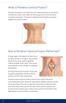 POSTERIOR CERVICAL FUSION - 8