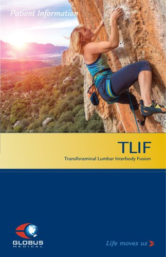 TLIF patient brochure