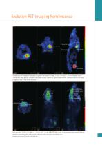 NanoScan PET/MRI - Mediso - PDF Catalogs | Technical Documentation