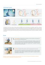 XFT-2001D G3 Foot Drop System-3