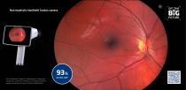 Optomed neurology-GetTheBigPicture brochure-2