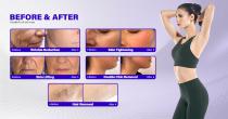 Perfectlaser Z350 Multi Function Laser Therapy Device-21
