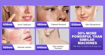 Perfectlaser Z350 Multi Function Laser Therapy Device-6