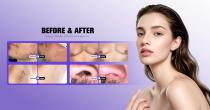 Perfectlaser Z890A Diode Laser Hair Removal Machine-13
