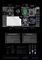 Myrian XP-Prostate - 2