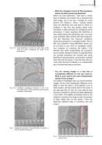 Vascular_interview - 2