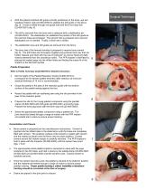 KineMatch® PFR-3