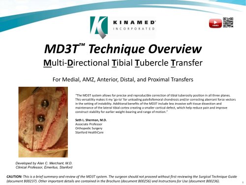 MD3T™ Technique Overview