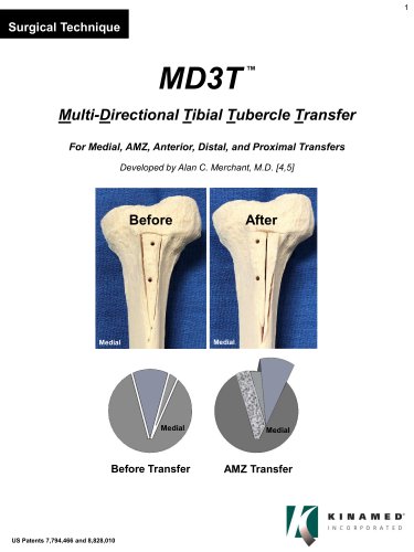 Multi-Directional Tibial Tubercle Transfer