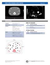 Image-Guided Abdominal Biopsy Phantom - 2