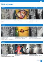BSS SCREW BROCHURE-5
