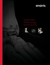 Total Ankle Arthroscopy and Fracture-1