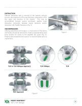 NEXXT MATRIXX® TLIF / TLIF Oblique Interbodies-4