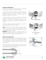 NEXXT MATRIXX® TLIF / TLIF Oblique Interbodies-5