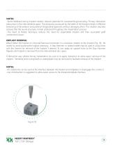 NEXXT MATRIXX® TLIF / TLIF Oblique Interbodies-9