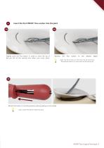 Surgical Technique - Meniscus Repair - MENIX® DUO-3