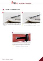 Surgical Technique - Meniscus Repair - MENIX® DUO-4
