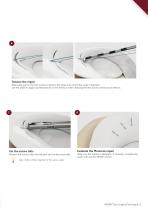 Surgical Technique - Meniscus Repair - MENIX® DUO-5