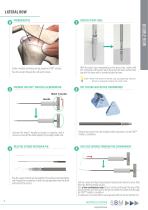 Surgical technique - Rotator cuff repair - FIXIT®/FIXIT® KNOTLESS-7