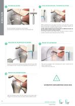 Surgical technique - Rotator cuff repair - FIXIT®/FIXIT® KNOTLESS-8