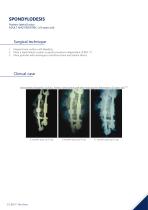 SYNTHETIC BONE SUBSTITUTES BONE VOID FILLERS-12