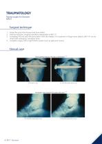 SYNTHETIC BONE SUBSTITUTES BONE VOID FILLERS-8
