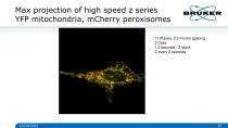 Multidimensional_Imaging_for_Complete_Investigation_of_Cellular_Events-20