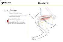 MouseFix-10